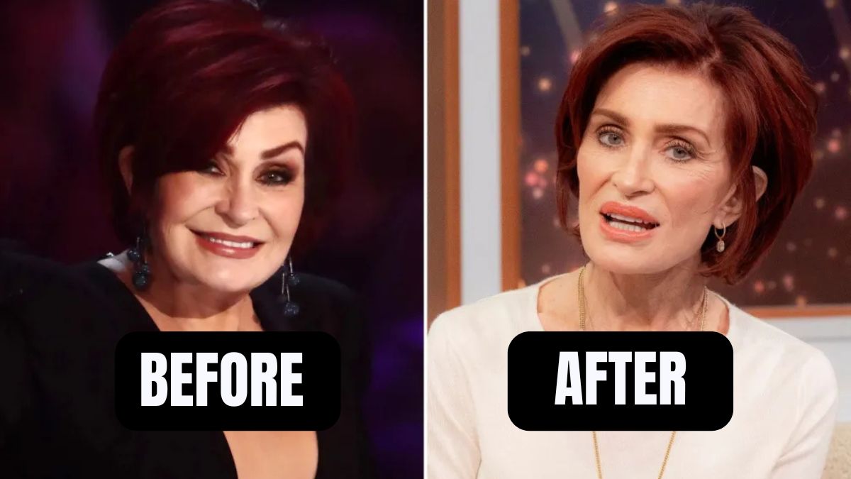 Sharon Osbourne’s Shocking 42-Pound Weight Loss Journey With Ozempic – Why She Stopped Taking It!