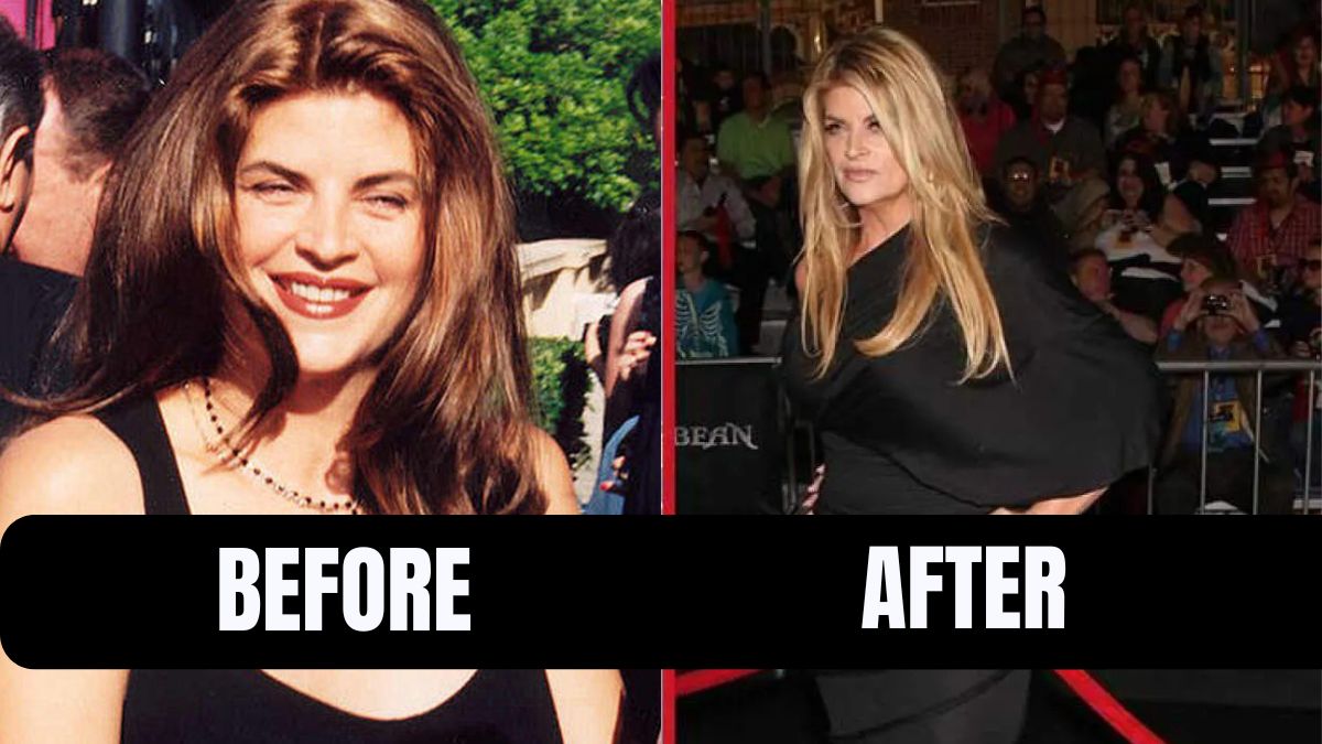 Kirstie Alley's Candid Weight Loss Journey: Turning Lemons Into Lemonade