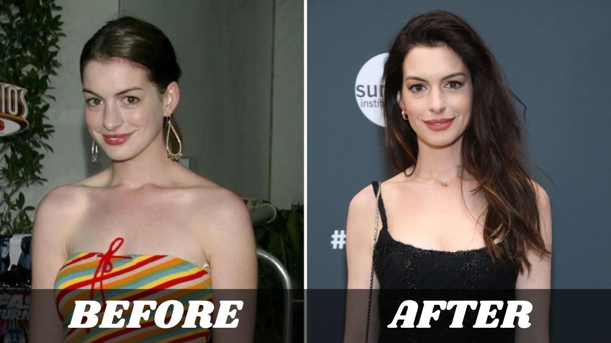 Anne Hathaway's Weight Loss Journey- How She Shed 25 Pounds for Les Misérables